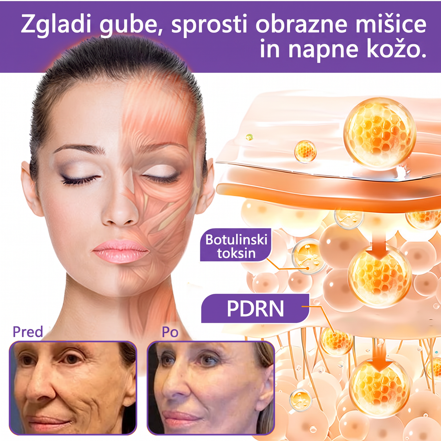 🇸🇮 Dermatološko priporočeno🥇 | 🍇Vitalisys® PDRN multi-peptidna masažna telesna kreme – Proti staranju, vlažilna, učvrstitvena, obbujevalna, izravnalna, za odstranjevanje aken in madežev, odstranjevanje bradavic in materinih znamenj, lajšanje luskavice.❤️