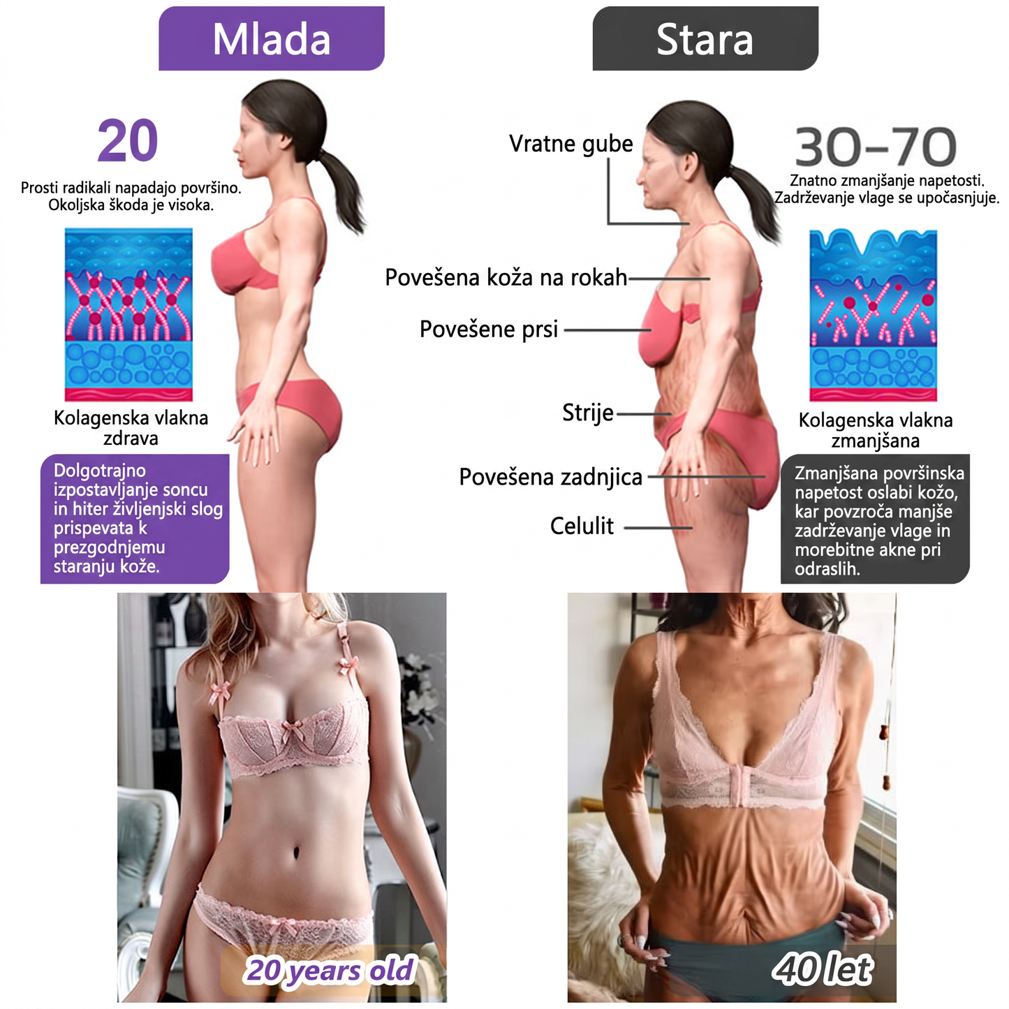 🇸🇮 Dermatološko priporočeno🥇 | 🍇Vitalisys® PDRN multi-peptidna masažna telesna kreme – Proti staranju, vlažilna, učvrstitvena, obbujevalna, izravnalna, za odstranjevanje aken in madežev, odstranjevanje bradavic in materinih znamenj, lajšanje luskavice.❤️