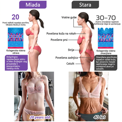 🇸🇮 Dermatološko priporočeno🥇 | 🍇Vitalisys® PDRN multi-peptidna masažna telesna kreme – Proti staranju, vlažilna, učvrstitvena, obbujevalna, izravnalna, za odstranjevanje aken in madežev, odstranjevanje bradavic in materinih znamenj, lajšanje luskavice.❤️