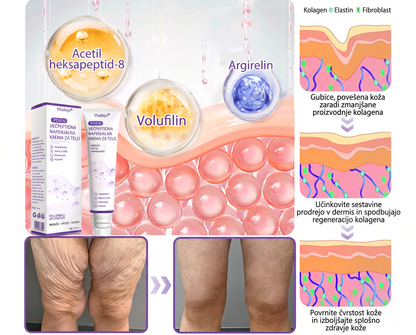 🇸🇮 Dermatološko priporočeno🥇 | 🍇Vitalisys® PDRN multi-peptidna masažna telesna kreme – Proti staranju, vlažilna, učvrstitvena, obbujevalna, izravnalna, za odstranjevanje aken in madežev, odstranjevanje bradavic in materinih znamenj, lajšanje luskavice.❤️