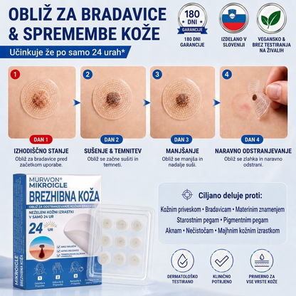 🇸🇮 Visokokakovosten slovenski izdelek, hitra domača dostava | MURWON® 🏠 Mikroiglični obliži za zmanjšanje videza kožnih nepravilnosti 🍉 (Za kožne izrastke, bradavice, znamenja, pigmentne madeže in druge vidne kožne nepravilnosti.) ❤️