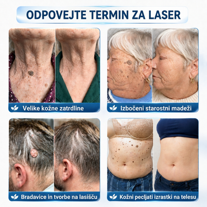 🇸🇮 Visokokakovosten slovenski izdelek, hitra domača dostava | MURWON® 🏠 Mikroiglični obliži za zmanjšanje videza kožnih nepravilnosti 🍉 (Za kožne izrastke, bradavice, znamenja, pigmentne madeže in druge vidne kožne nepravilnosti.) ❤️