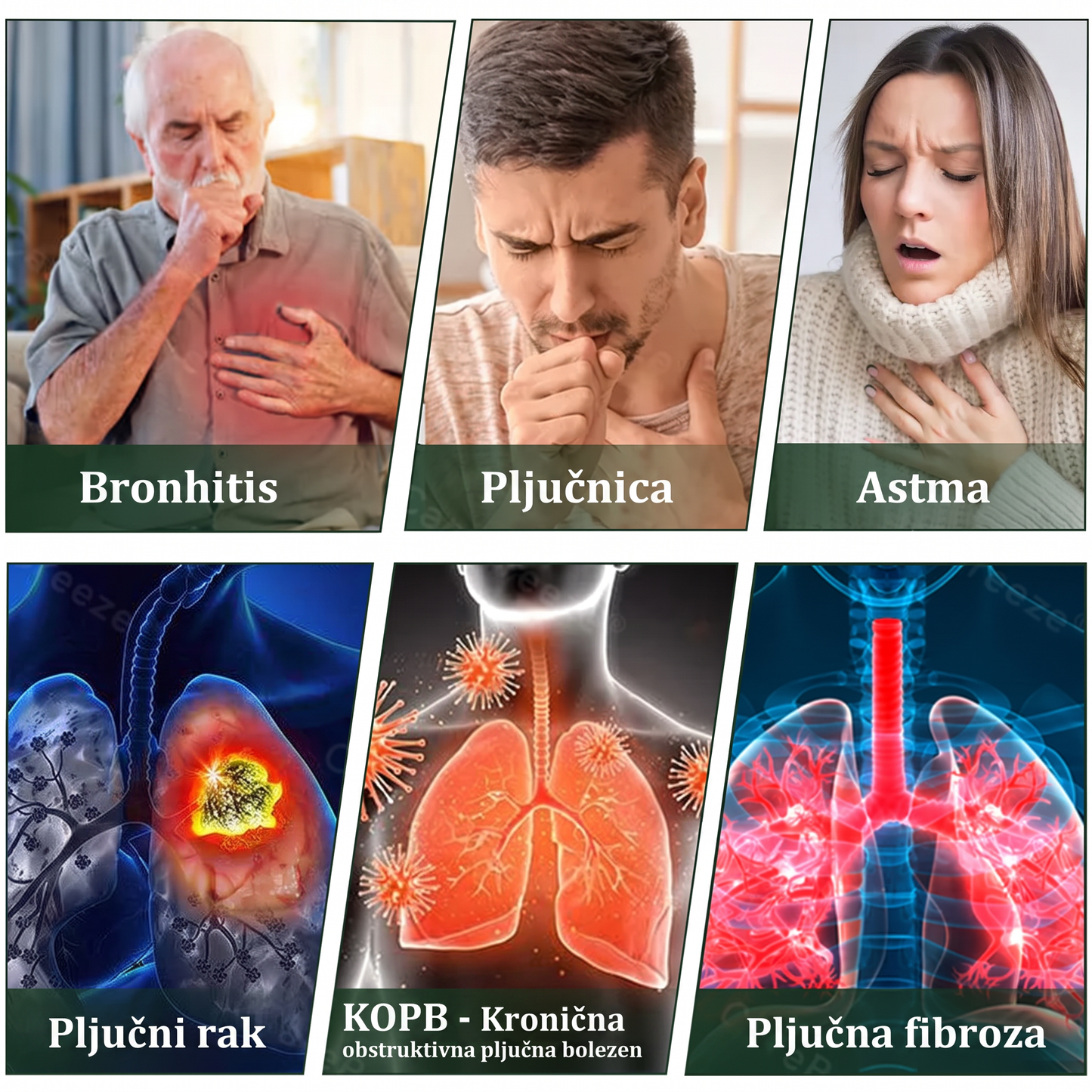 Vrhunski slovenski izdelek z domačo dostavo 🥇 Murwon® zeliščni parni inhalator za čiščenje pljuč 🍋 (👨‍⚕️ Učinkovita pomoč pri kašlju, vnetju grla, težkem dihanju, nastajanju sluzi, zamašenem nosu, bronhitisu, alergijskih simptomih in težavah s pljuči) ❤️