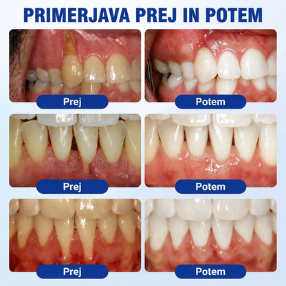 Priporočajo zobozdravniki 👨‍⚕️🦷🛡️ Vitalisys® GumRevive – parodontalni obnovitveni gel 🌥️❤️