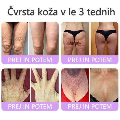 🇸🇮 Dermatološko priporočeno🥇 | 🍇Vitalisys® PDRN multi-peptidna masažna telesna kreme – Proti staranju, vlažilna, učvrstitvena, obbujevalna, izravnalna, za odstranjevanje aken in madežev, odstranjevanje bradavic in materinih znamenj, lajšanje luskavice.❤️