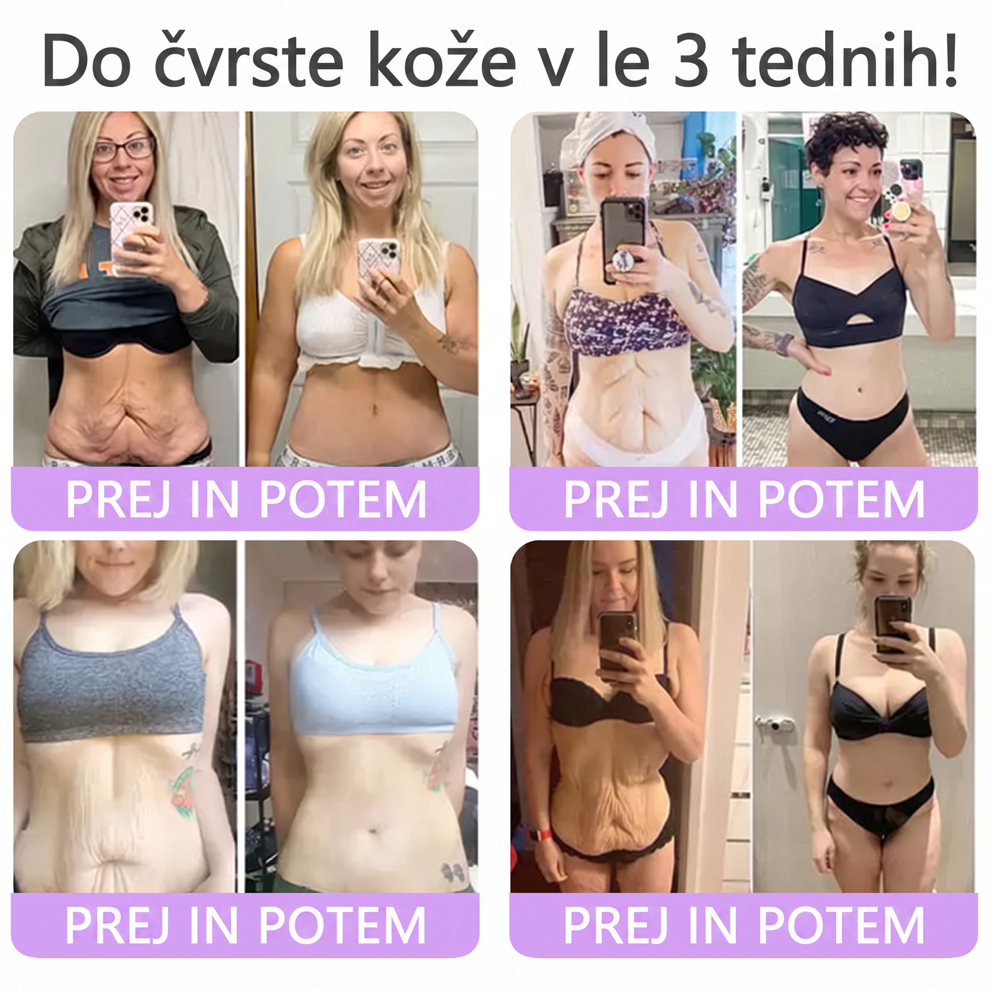 🇸🇮 Dermatološko priporočeno🥇 | 🍇Vitalisys® PDRN multi-peptidna masažna telesna kreme – Proti staranju, vlažilna, učvrstitvena, obbujevalna, izravnalna, za odstranjevanje aken in madežev, odstranjevanje bradavic in materinih znamenj, lajšanje luskavice.❤️