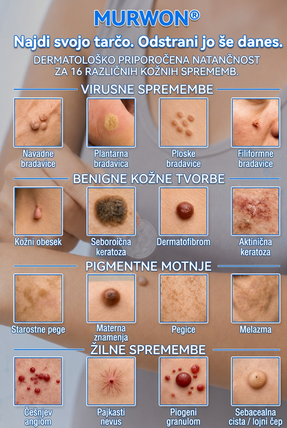 🇸🇮 Visokokakovosten slovenski izdelek, hitra domača dostava | MURWON® 🏠 Mikroiglični obliži za zmanjšanje videza kožnih nepravilnosti 🍉 (Za kožne izrastke, bradavice, znamenja, pigmentne madeže in druge vidne kožne nepravilnosti.) ❤️