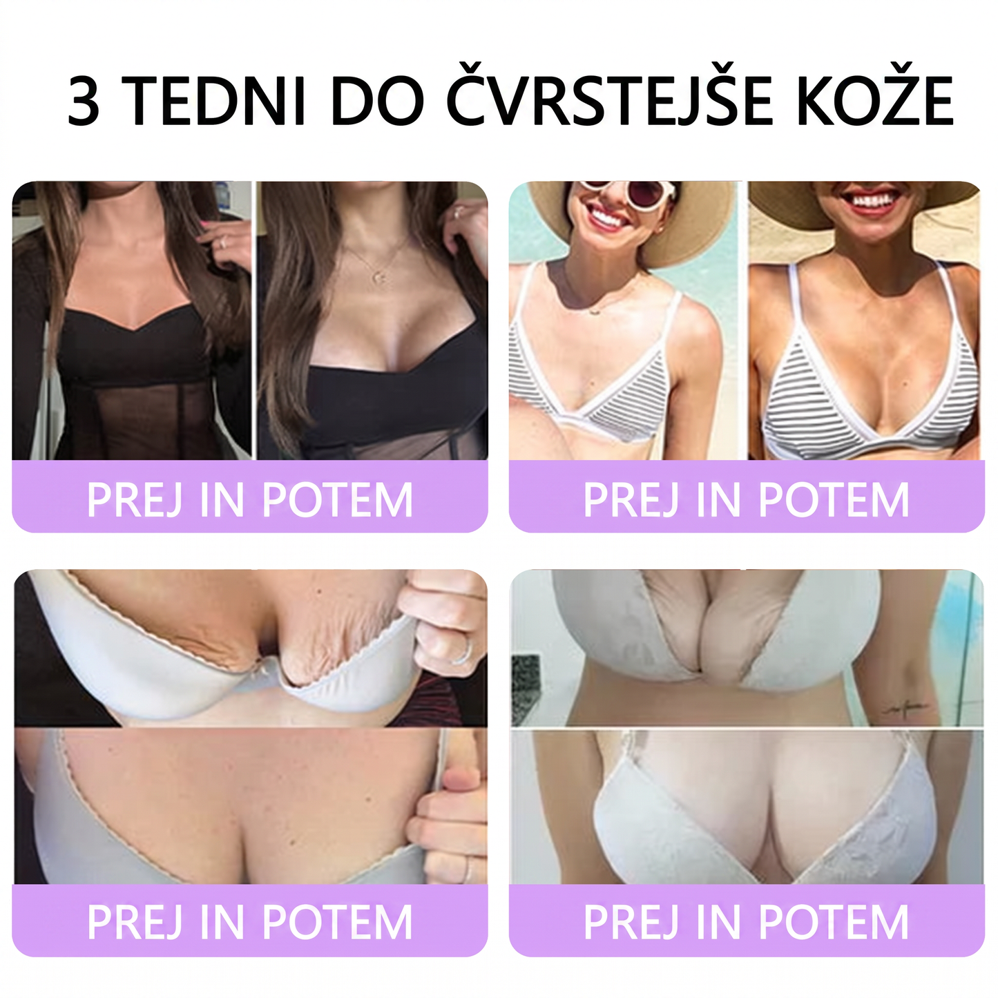 🇸🇮 Dermatološko priporočeno🥇 | 🍇Vitalisys® PDRN multi-peptidna masažna telesna kreme – Proti staranju, vlažilna, učvrstitvena, obbujevalna, izravnalna, za odstranjevanje aken in madežev, odstranjevanje bradavic in materinih znamenj, lajšanje luskavice.❤️
