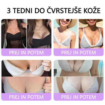 🇸🇮 Dermatološko priporočeno🥇 | 🍇Vitalisys® PDRN multi-peptidna masažna telesna kreme – Proti staranju, vlažilna, učvrstitvena, obbujevalna, izravnalna, za odstranjevanje aken in madežev, odstranjevanje bradavic in materinih znamenj, lajšanje luskavice.❤️