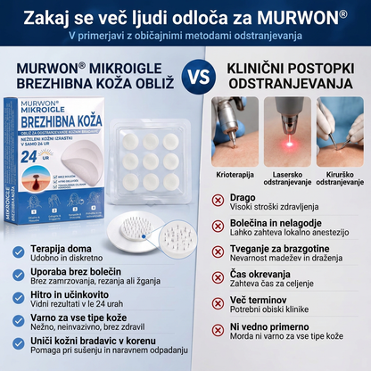 🇸🇮 Visokokakovosten slovenski izdelek, hitra domača dostava | MURWON® 🏠 Mikroiglični obliži za zmanjšanje videza kožnih nepravilnosti 🍉 (Za kožne izrastke, bradavice, znamenja, pigmentne madeže in druge vidne kožne nepravilnosti.) ❤️