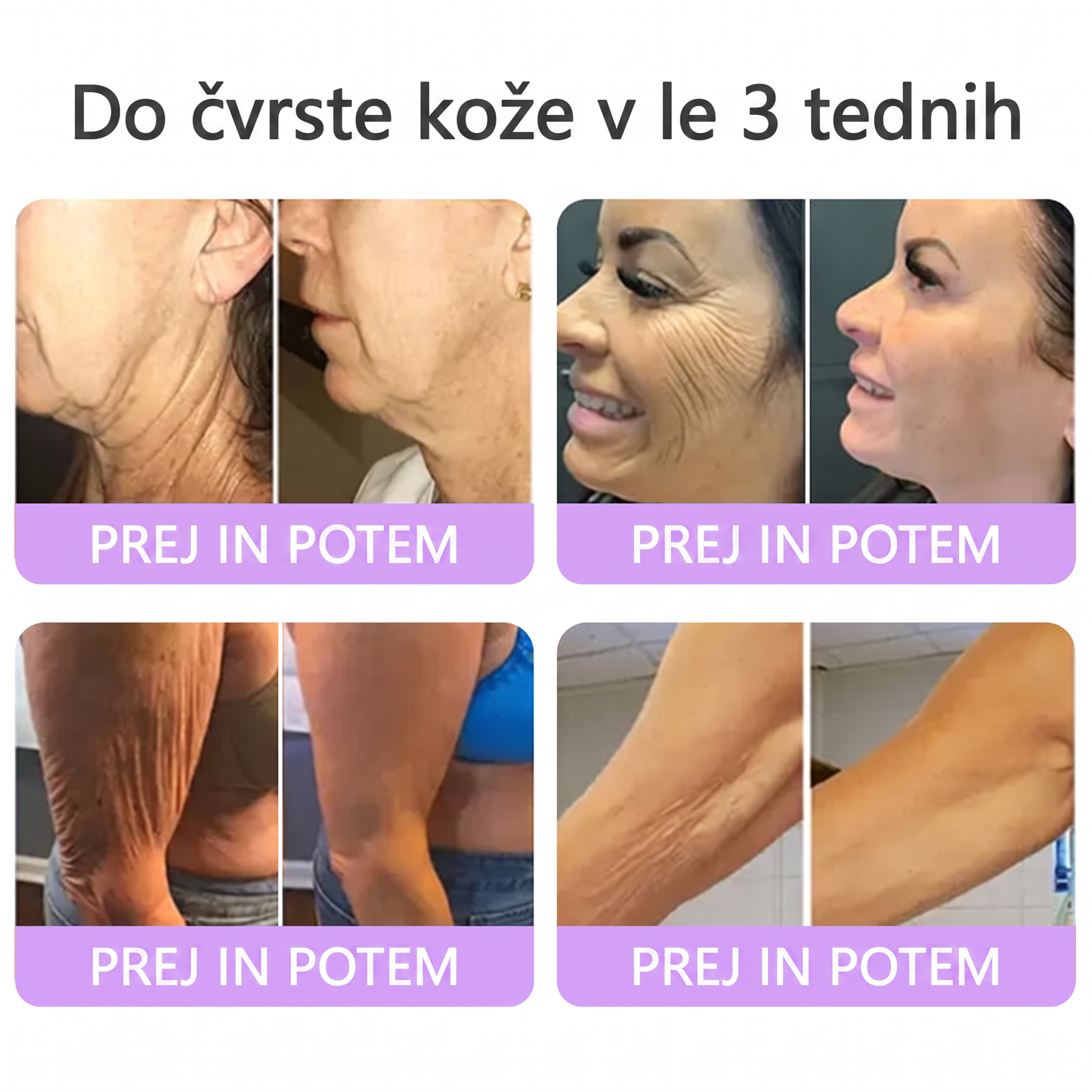 🇸🇮 Dermatološko priporočeno🥇 | 🍇Vitalisys® PDRN multi-peptidna masažna telesna kreme – Proti staranju, vlažilna, učvrstitvena, obbujevalna, izravnalna, za odstranjevanje aken in madežev, odstranjevanje bradavic in materinih znamenj, lajšanje luskavice.❤️