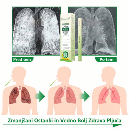 Vrhunski slovenski izdelek z domačo dostavo 🥇 Murwon® zeliščni parni inhalator za čiščenje pljuč 🍇 (👨‍⚕️ Učinkovita pomoč pri kašlju, vnetju grla, težkem dihanju, nastajanju sluzi, zamašenem nosu, bronhitisu, alergijskih simptomih in težavah s pljuči) ❤️