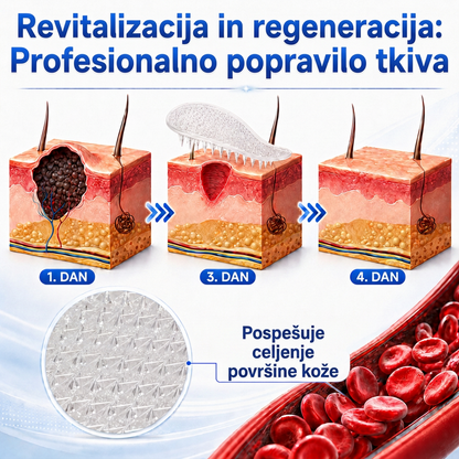 🇸🇮 Visokokakovosten slovenski izdelek, hitra domača dostava | MURWON® 🏠 Mikroiglični obliži za zmanjšanje videza kožnih nepravilnosti 🍉 (Za kožne izrastke, bradavice, znamenja, pigmentne madeže in druge vidne kožne nepravilnosti.) ❤️
