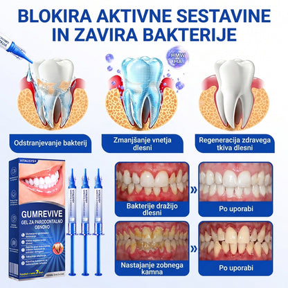 Priporočajo zobozdravniki 👨‍⚕️🦷🛡️ Vitalisys® GumRevive – parodontalni obnovitveni gel 🌥️❤️