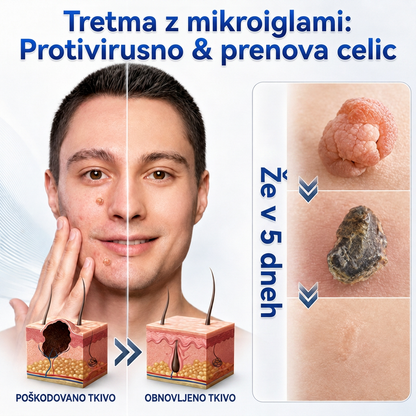 🇸🇮 Visokokakovosten slovenski izdelek, hitra domača dostava | MURWON® 🏠 Mikroiglični obliži za zmanjšanje videza kožnih nepravilnosti 🍉 (Za kožne izrastke, bradavice, znamenja, pigmentne madeže in druge vidne kožne nepravilnosti.) ❤️