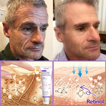 🇸🇮 Dermatološko priporočeno🥇 | 🍇Vitalisys® PDRN multi-peptidna masažna telesna kreme – Proti staranju, vlažilna, učvrstitvena, obbujevalna, izravnalna, za odstranjevanje aken in madežev, odstranjevanje bradavic in materinih znamenj, lajšanje luskavice.❤️